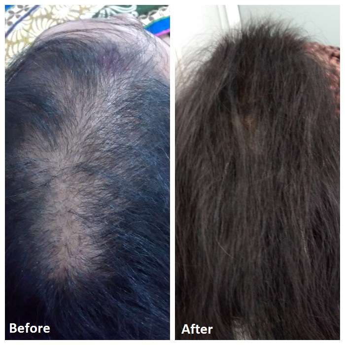 Peachtree Beauty, Hair & Slimming Clinic Image 5