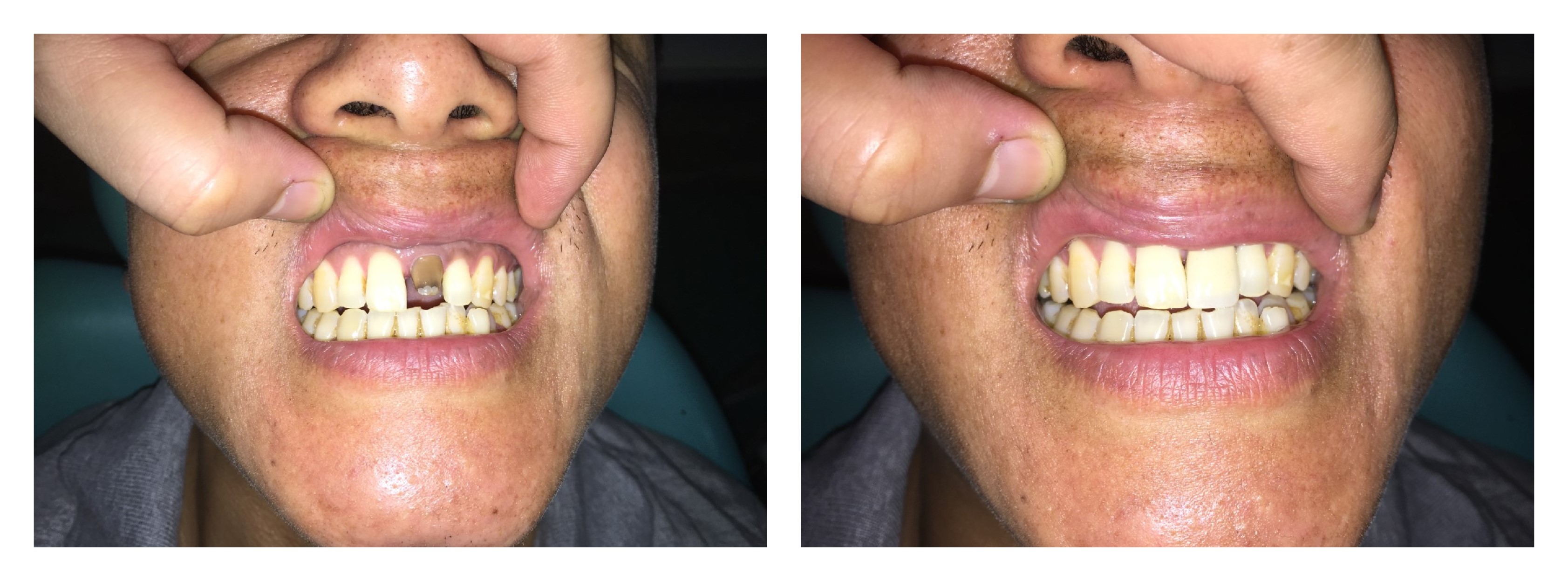 Mayur Dental Clinic Image 6