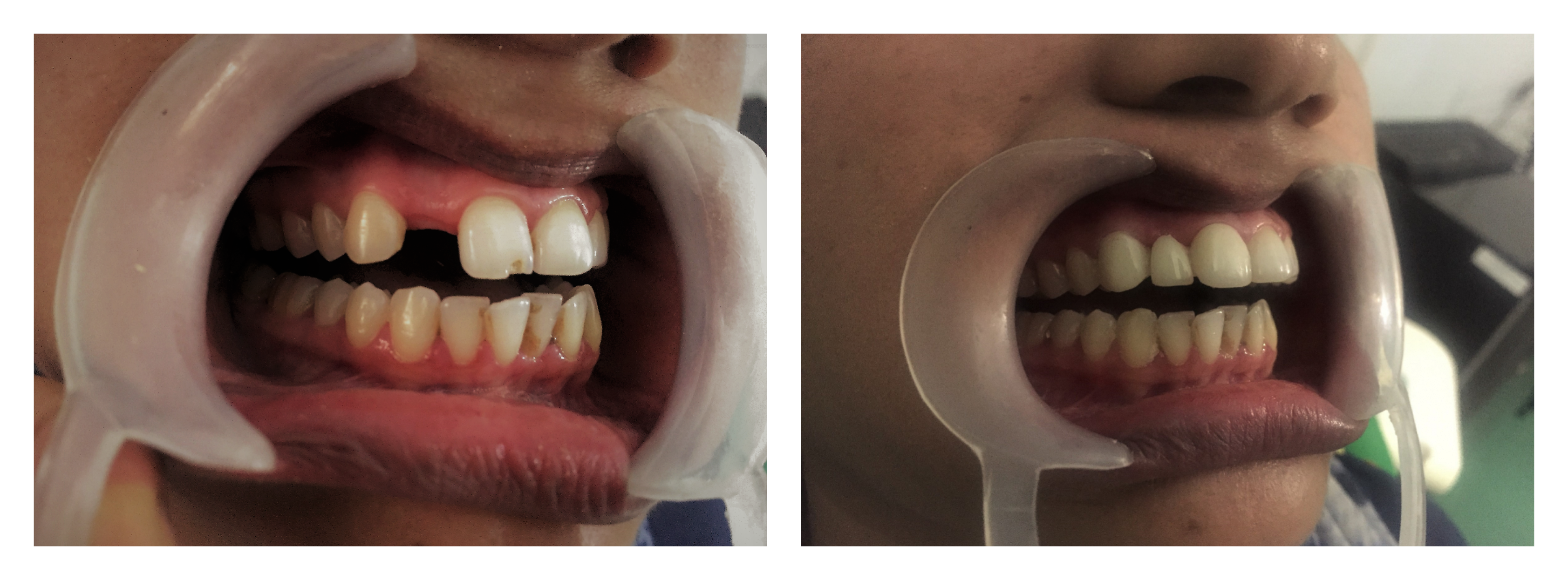 Mayur Dental Clinic Image 4