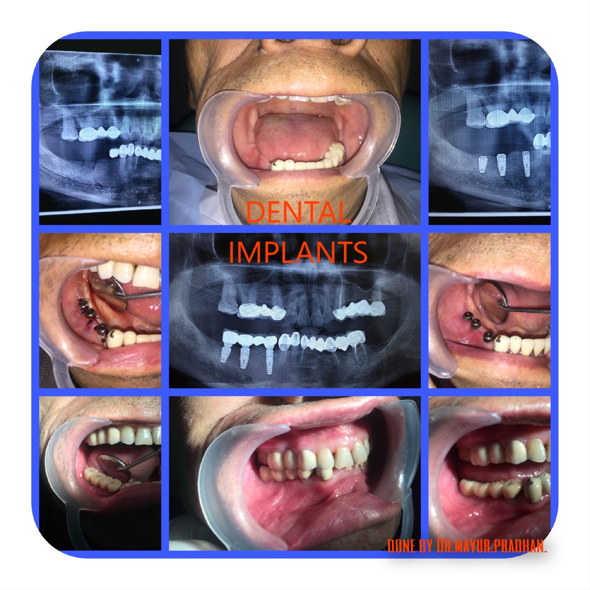 Mayur Dental Clinic Image 3