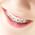 Smile Xpertz Image 5