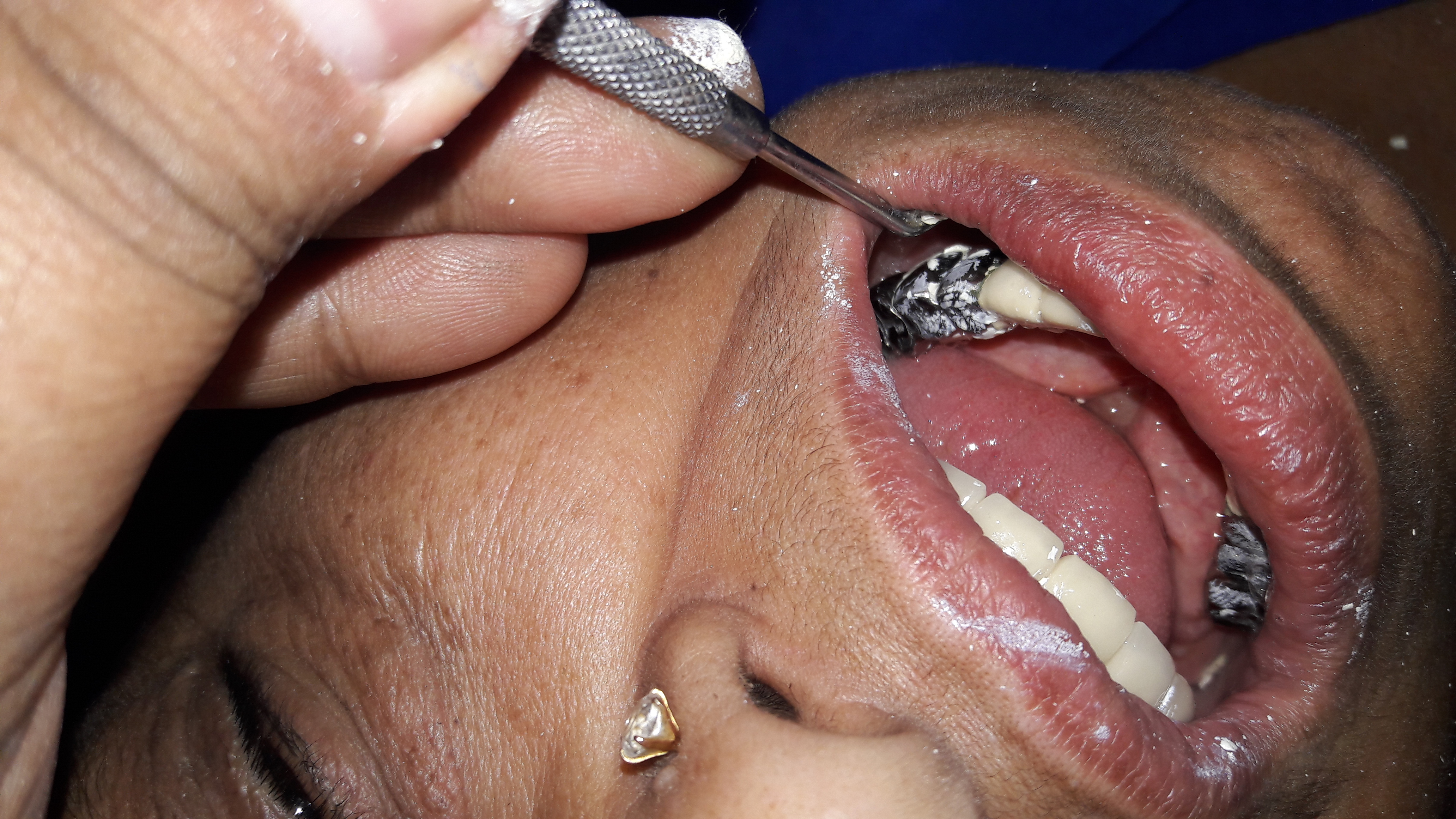 Garg Dental Clinic & Oral Rehabilitation Center Image 12