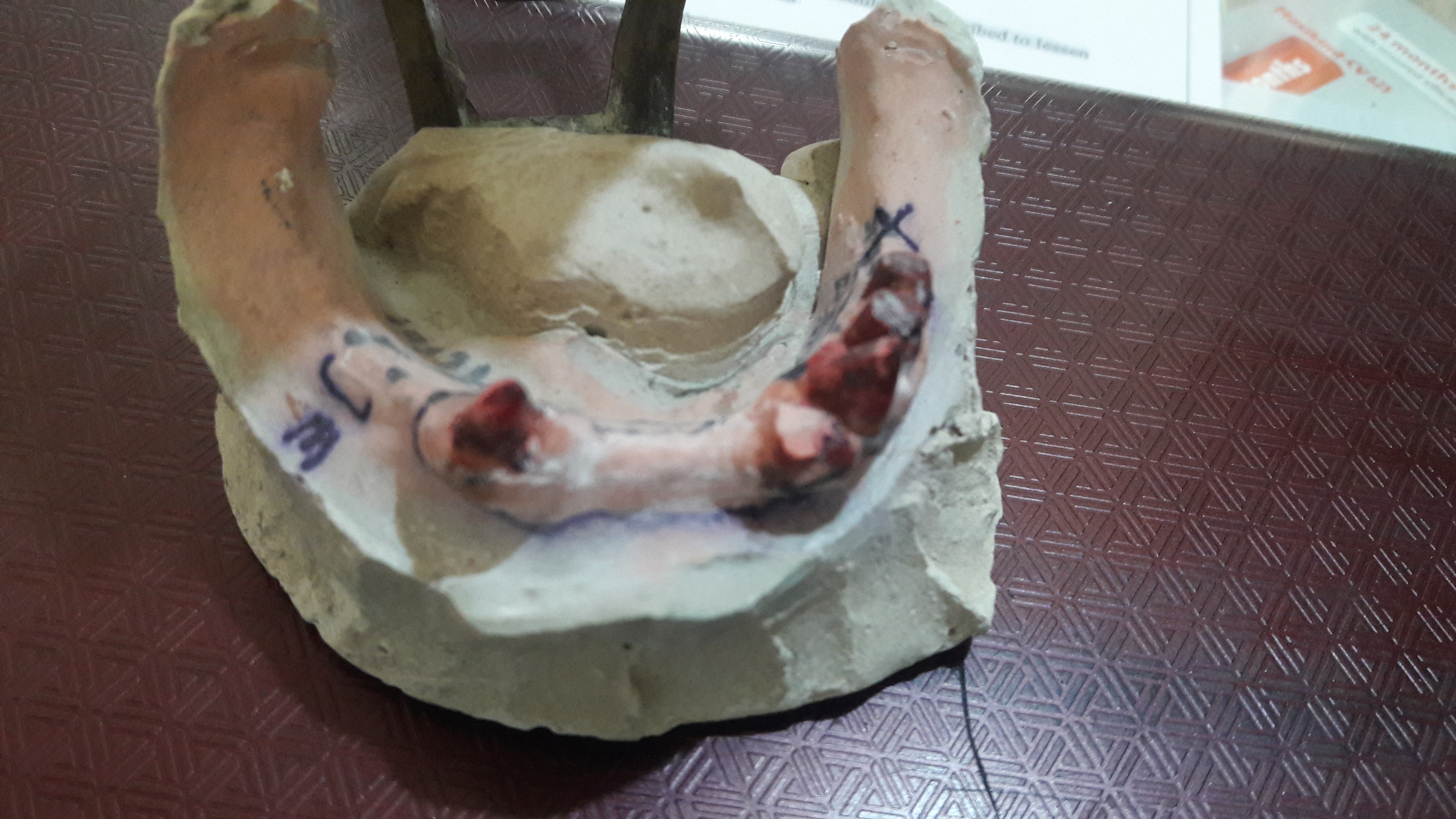 Garg Dental Clinic & Oral Rehabilitation Center Image 9