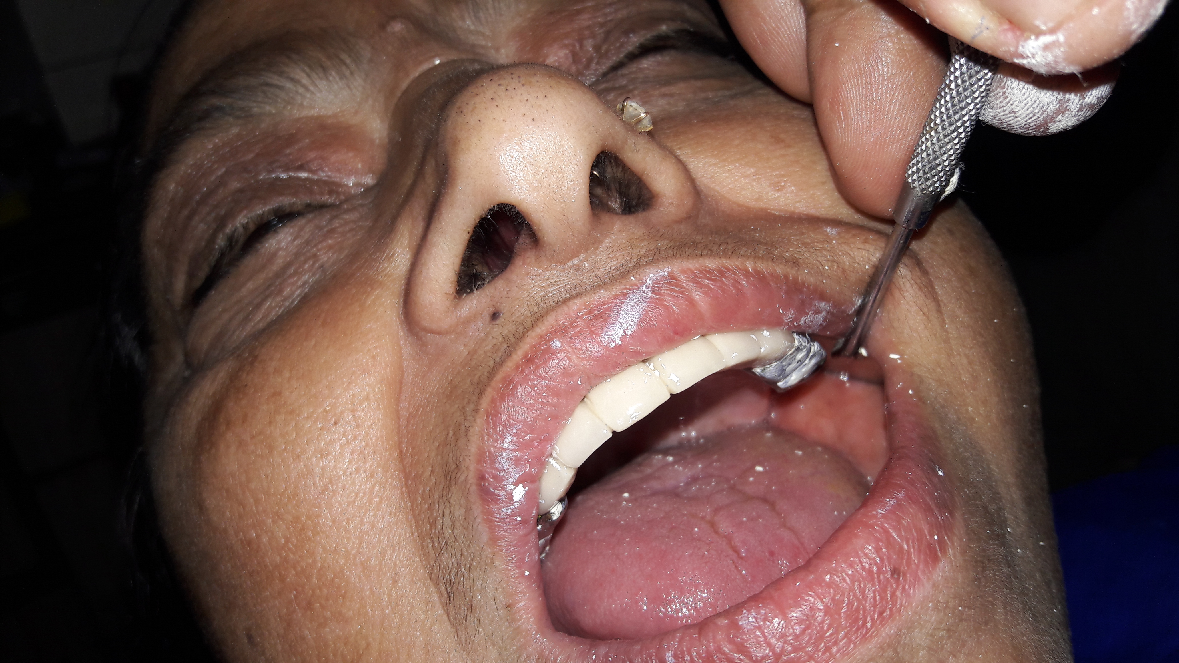 Garg Dental Clinic & Oral Rehabilitation Center Image 13