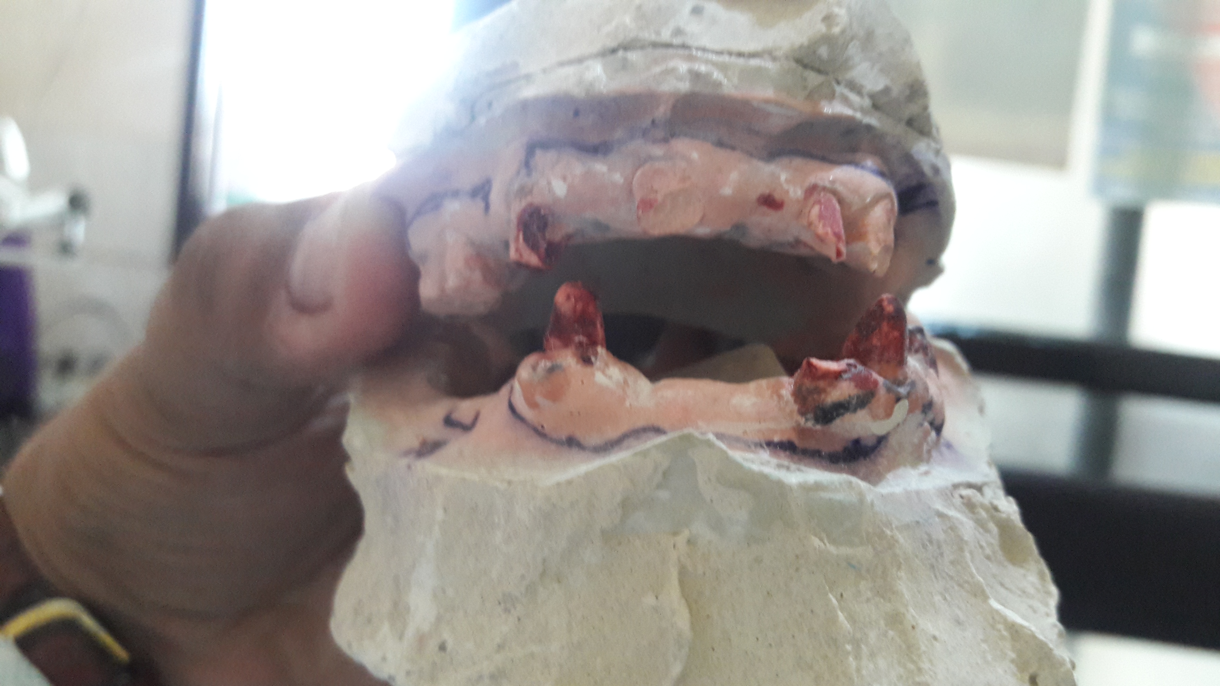 Garg Dental Clinic & Oral Rehabilitation Center Image 10