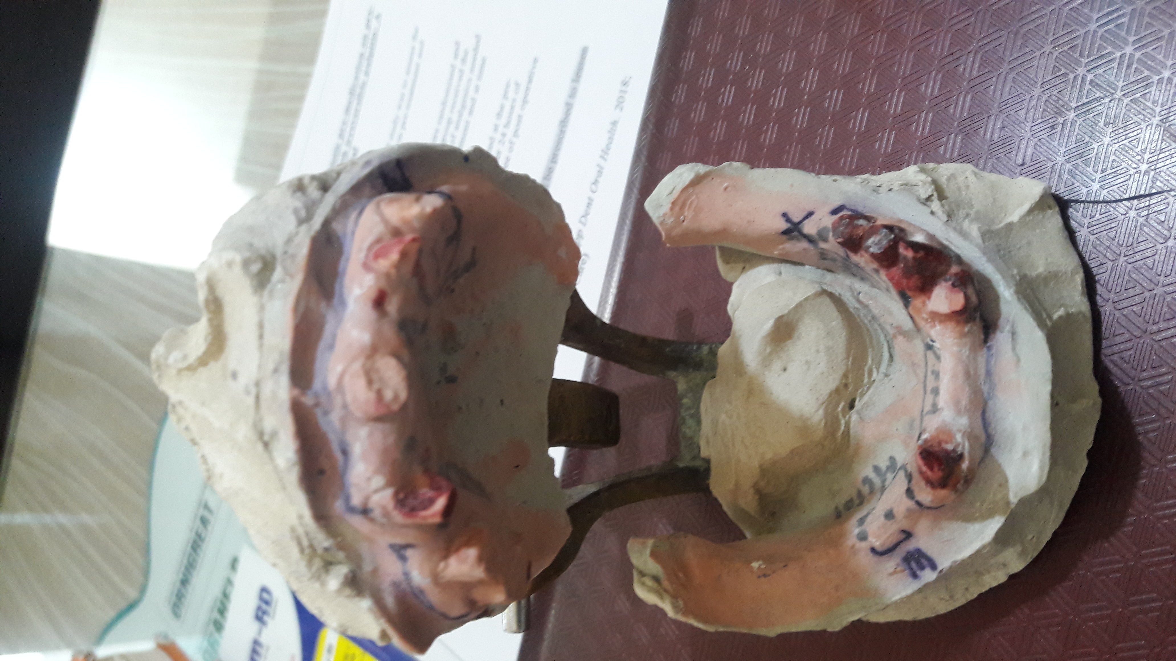 Garg Dental Clinic & Oral Rehabilitation Center Image 7