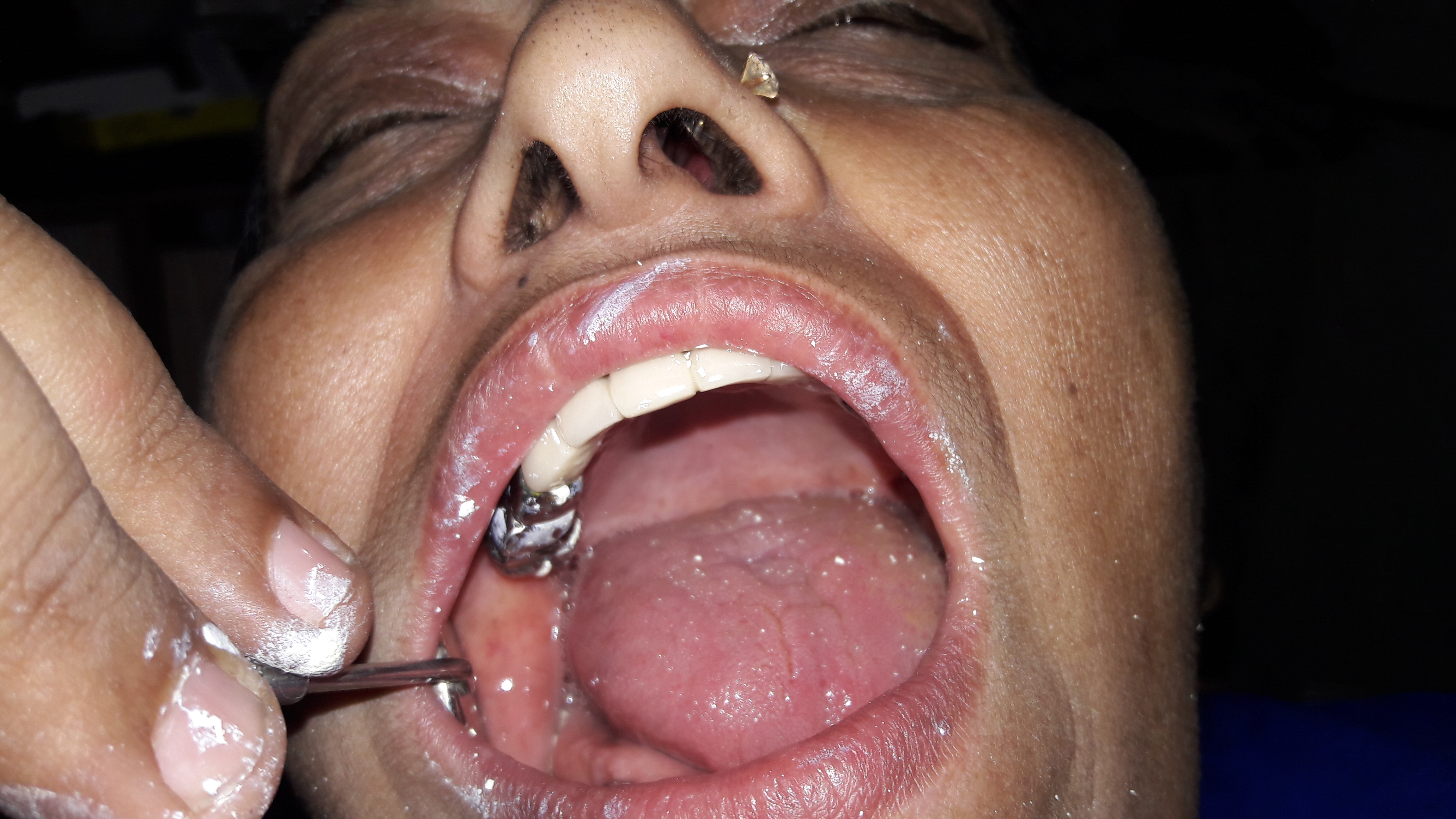 Garg Dental Clinic & Oral Rehabilitation Center Image 11