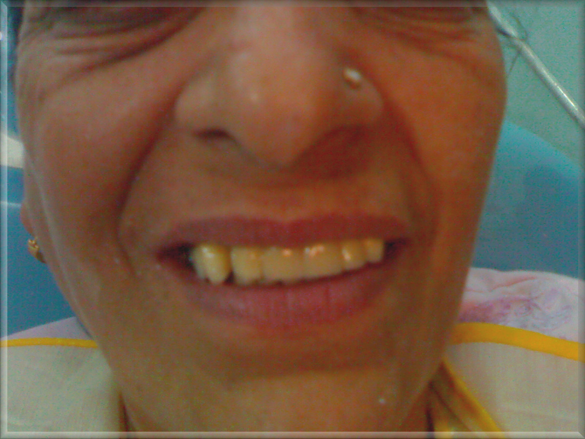 Advance Dental Clinic and Oral Rehabilitation Centre Image 2