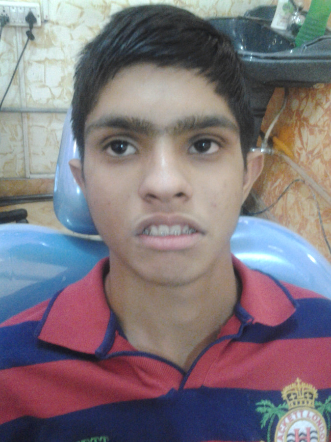 Advance Dental Clinic and Oral Rehabilitation Centre Image 1