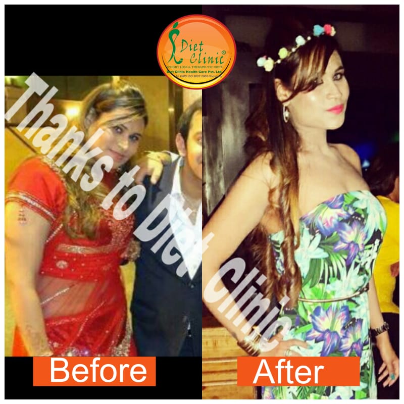 Diet Clinic - Preet Vihar Image 16
