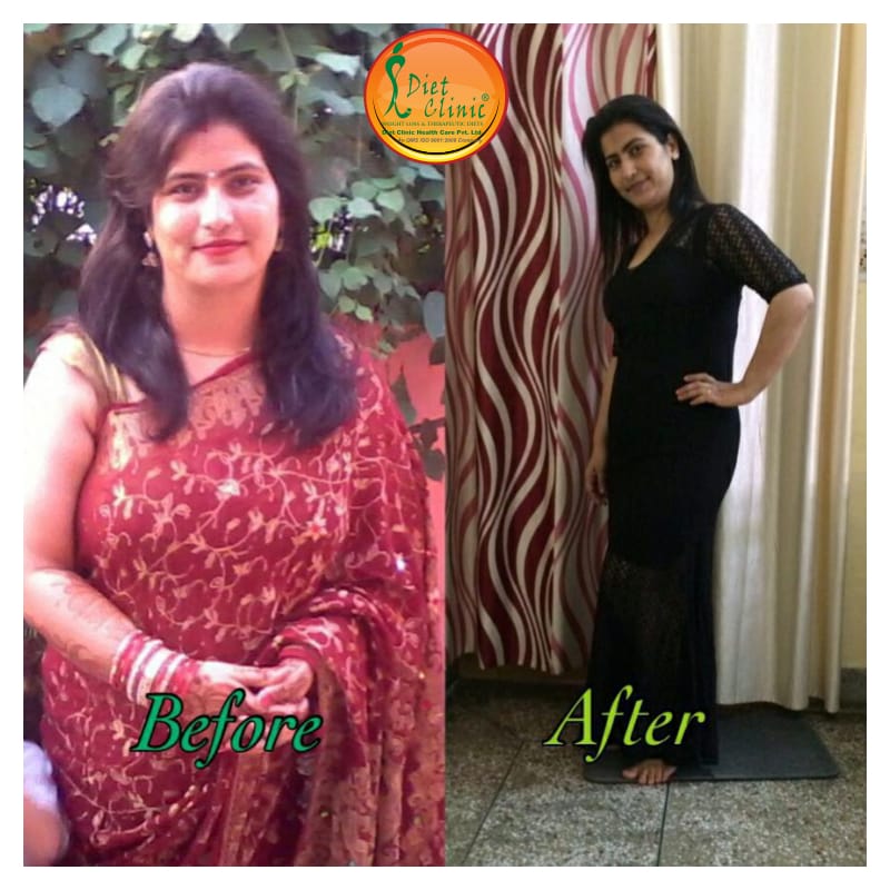 Diet Clinic - Preet Vihar Image 14
