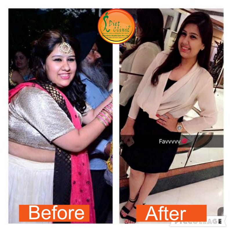 Diet Clinic - Preet Vihar Image 22