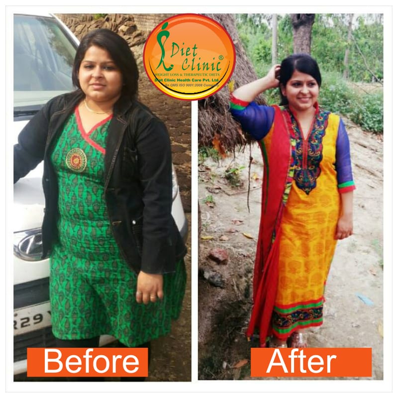 Diet Clinic - Preet Vihar Image 8