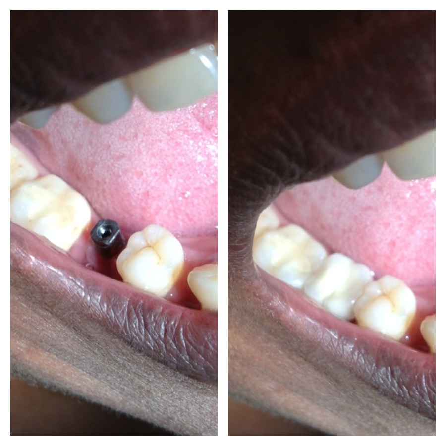 Dhanwanth Dental Care & Implant Center Image 2