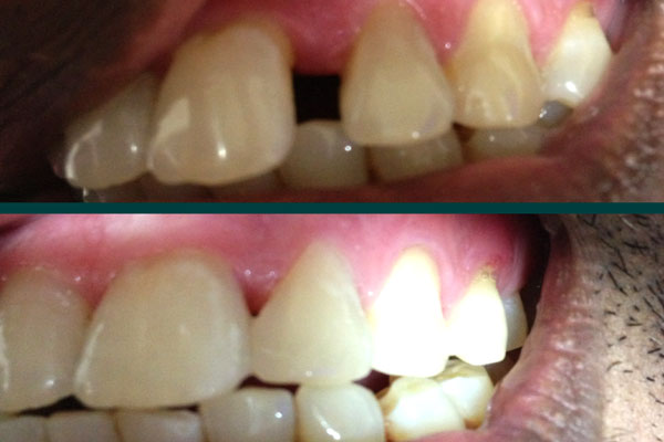 Dhanwanth Dental Care & Implant Center Image 4