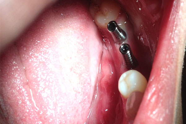 Dhanwanth Dental Care & Implant Center Image 21