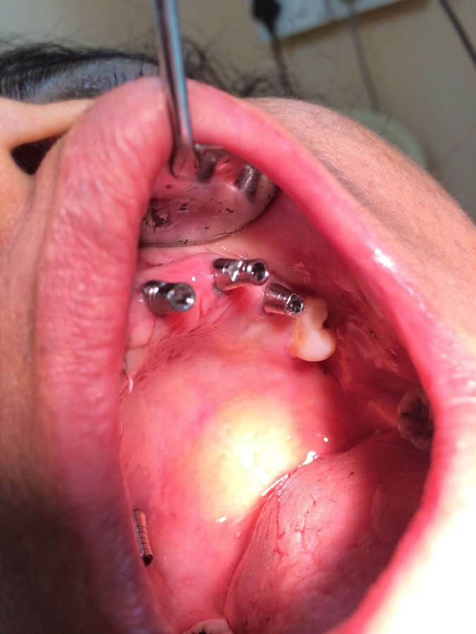 Dhanwanth Dental Care & Implant Center Image 6