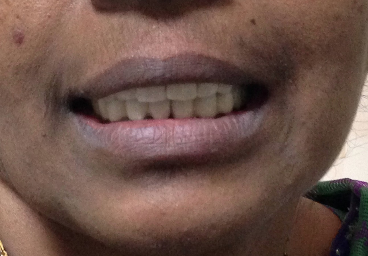Dhanwanth Dental Care & Implant Center Image 13