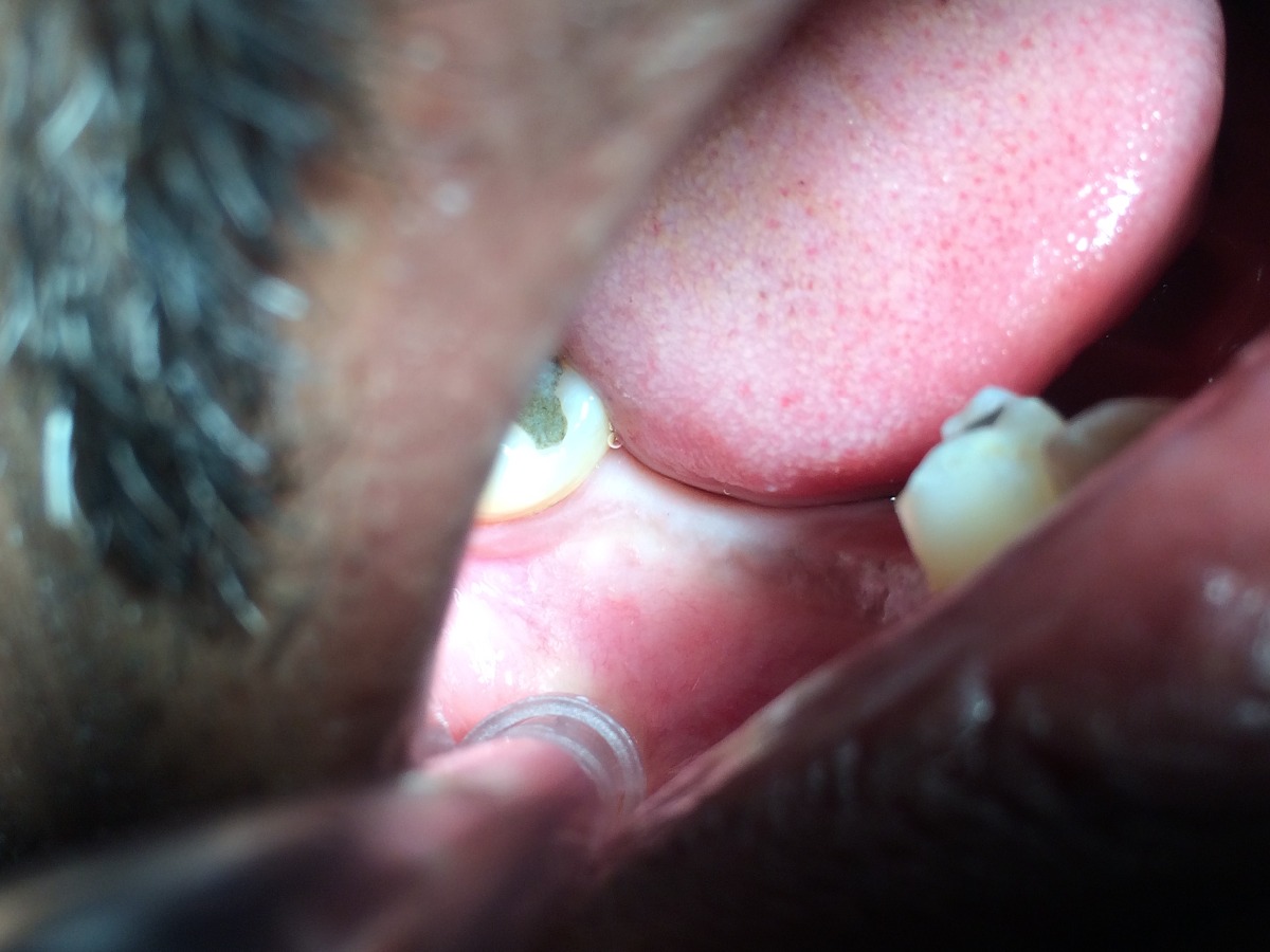 Dhanwanth Dental Care & Implant Center Image 16