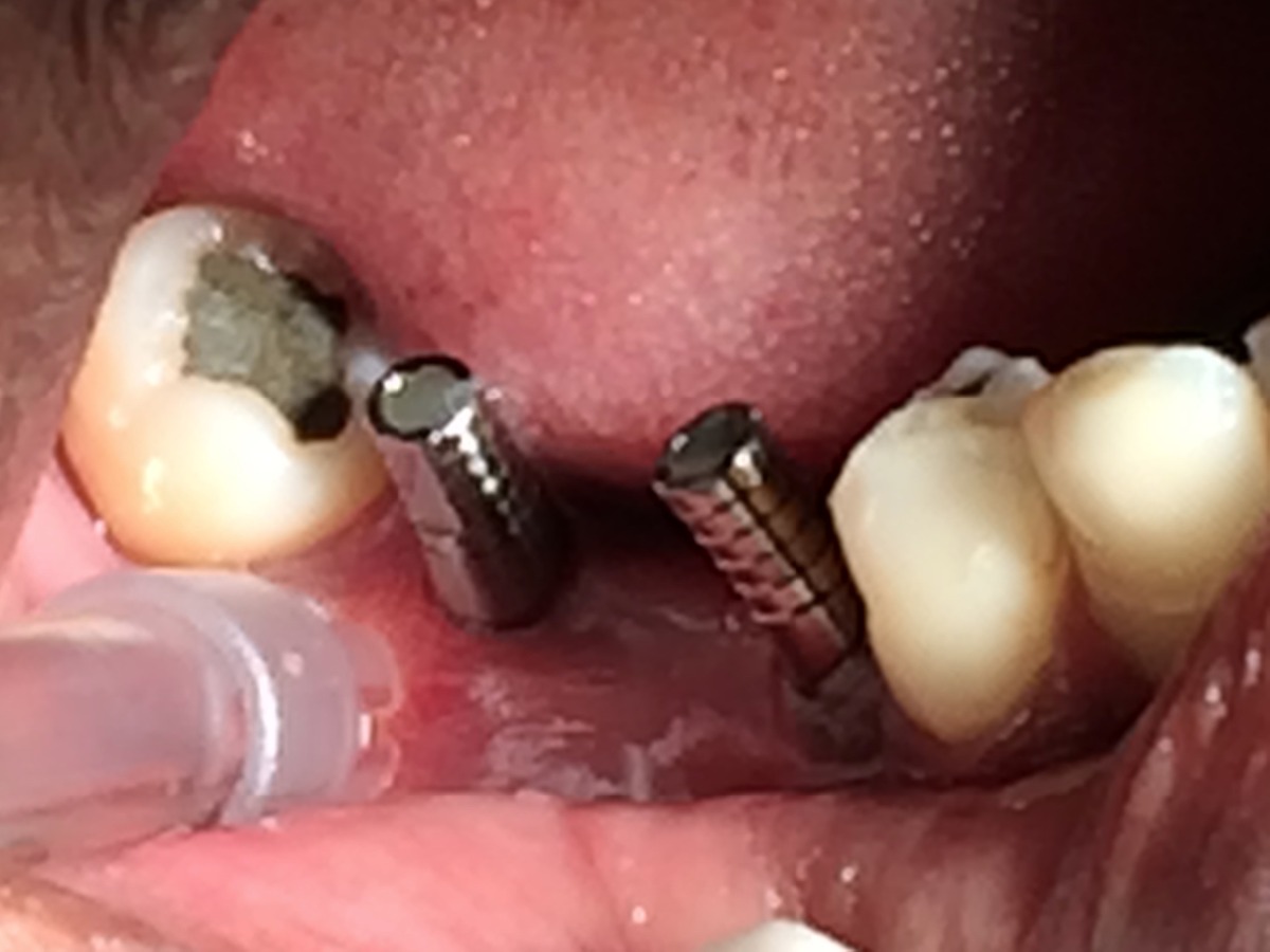 Dhanwanth Dental Care & Implant Center Image 17