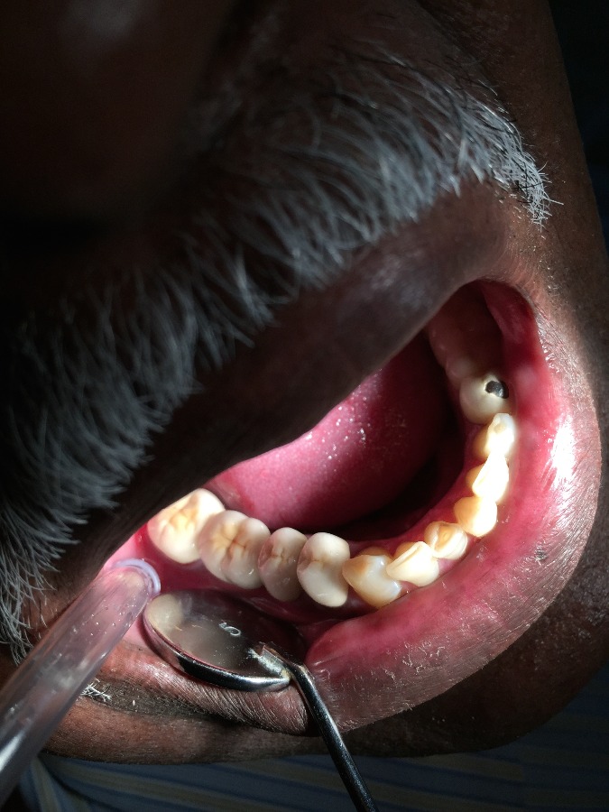 Dhanwanth Dental Care & Implant Center Image 15