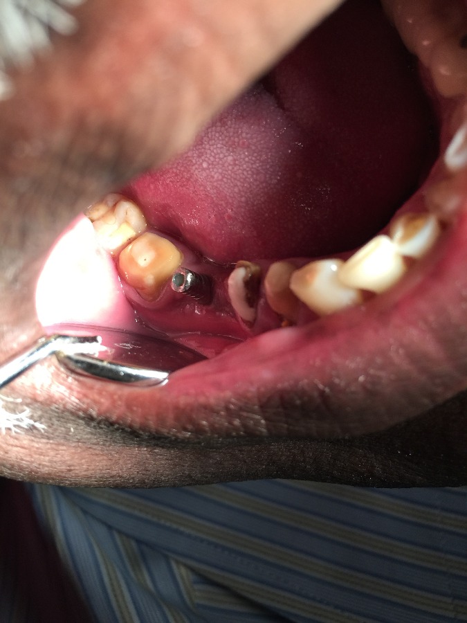 Dhanwanth Dental Care & Implant Center Image 14