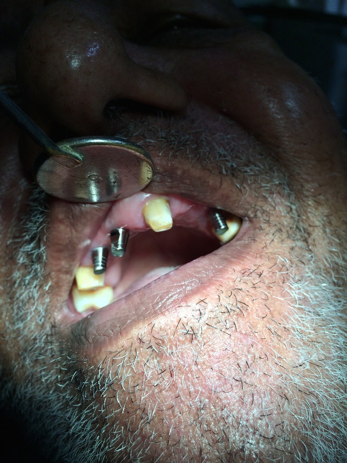 Dhanwanth Dental Care & Implant Center Image 7