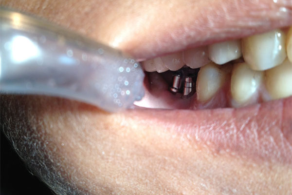 Dhanwanth Dental Care & Implant Center Image 20