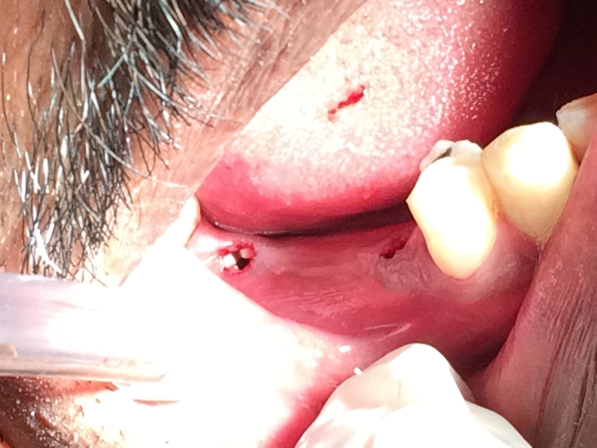 Dhanwanth Dental Care & Implant Center Image 18