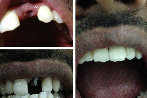 Dhanwanth Dental Care & Implant Center Image 5