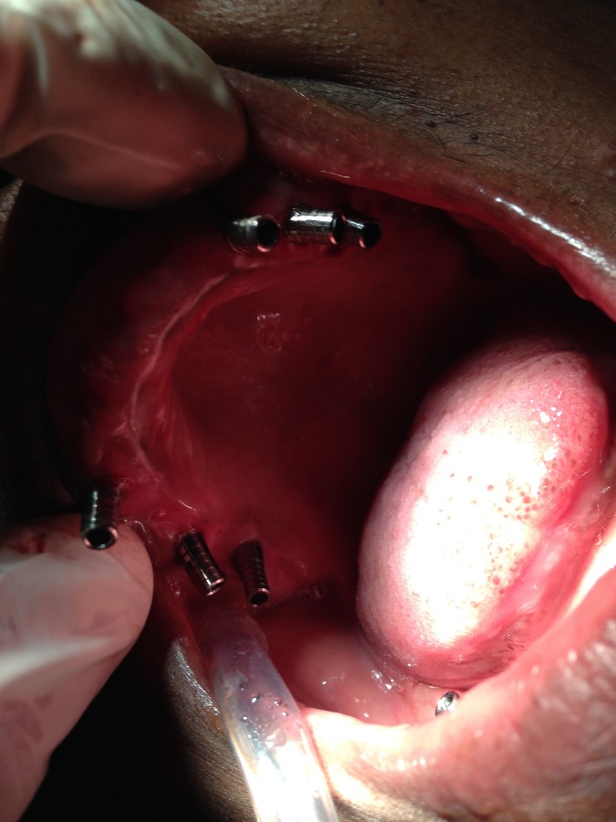 Dhanwanth Dental Care & Implant Center Image 11