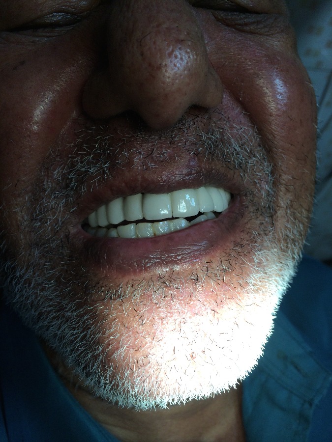 Dhanwanth Dental Care & Implant Center Image 9