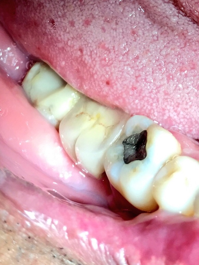 Dhanwanth Dental Care & Implant Center Image 25