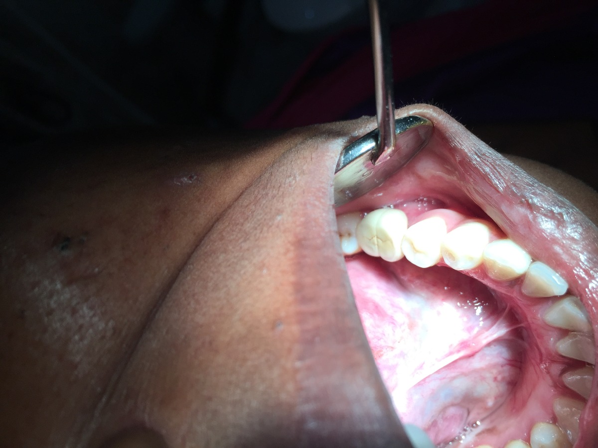 Dhanwanth Dental Care & Implant Center Image 26
