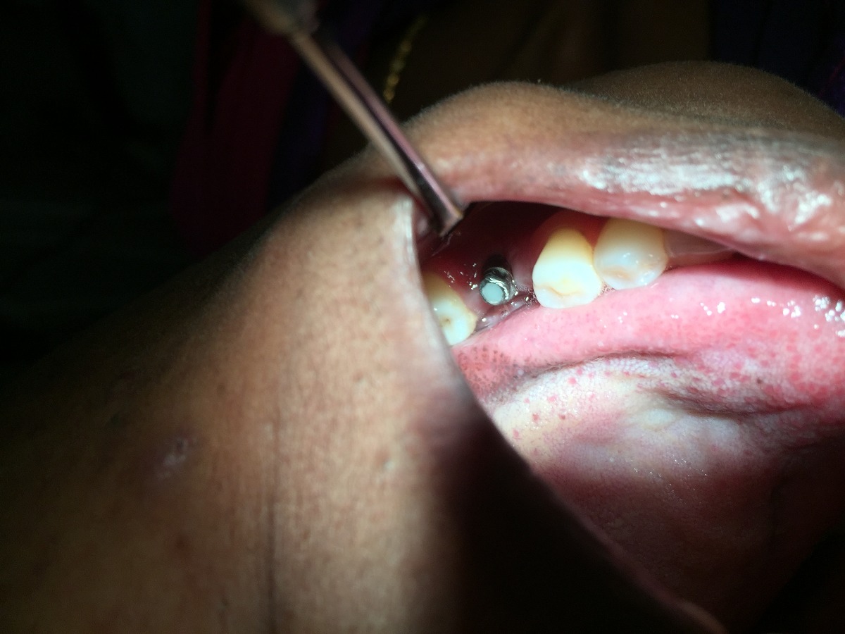Dhanwanth Dental Care & Implant Center Image 24