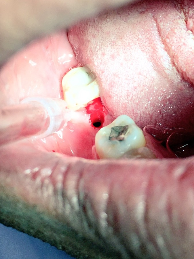 Dhanwanth Dental Care & Implant Center Image 23