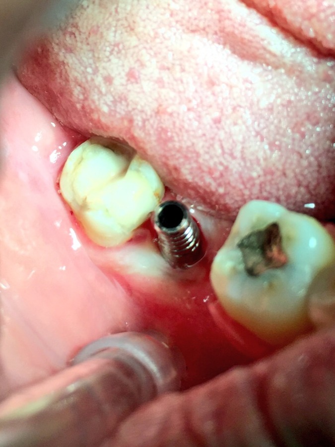 Dhanwanth Dental Care & Implant Center Image 22