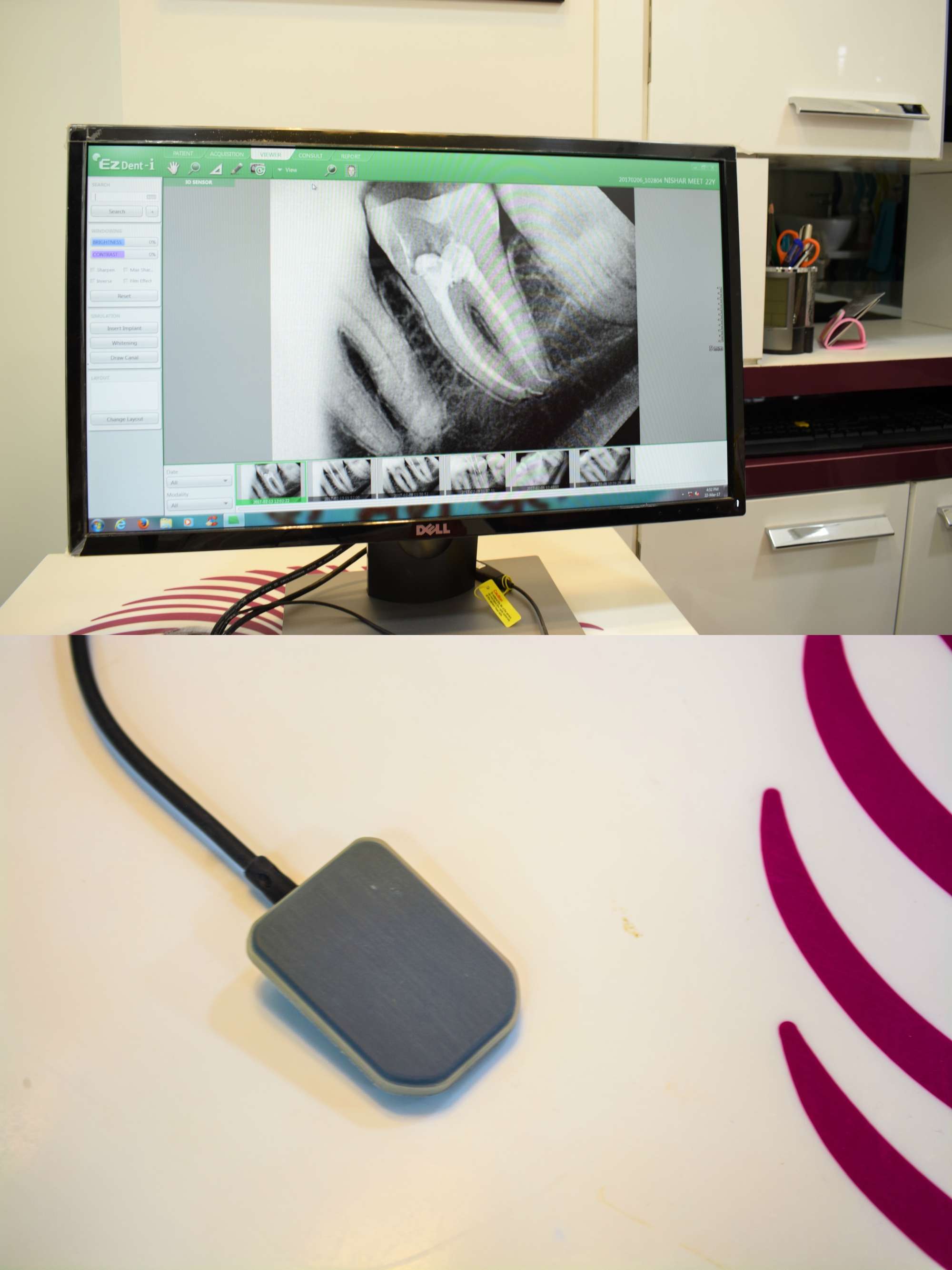 Smile Gallery Dental Clinic Image 6
