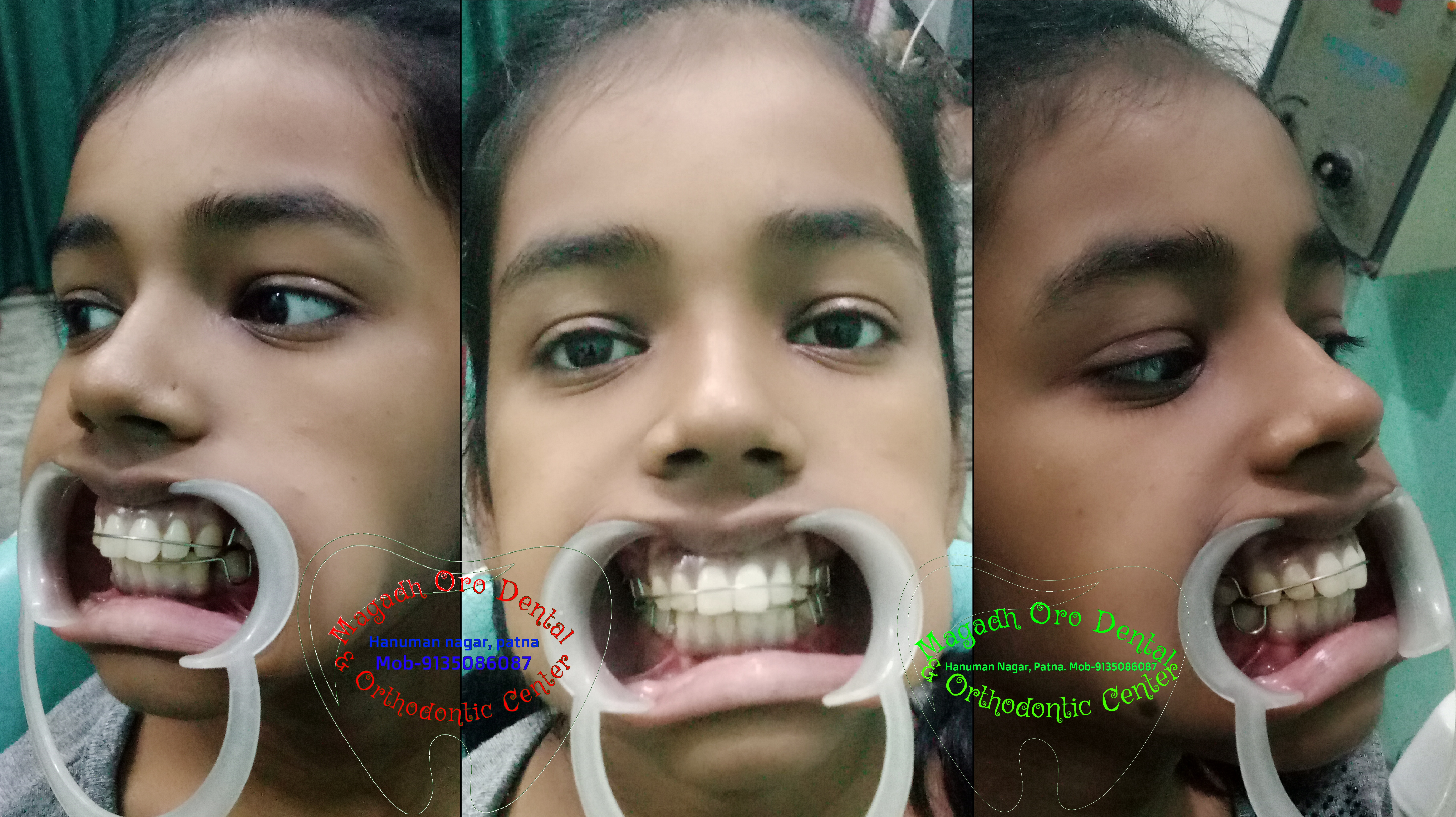 Magadh Oro Dental & Orthodontic Clinic Image 6