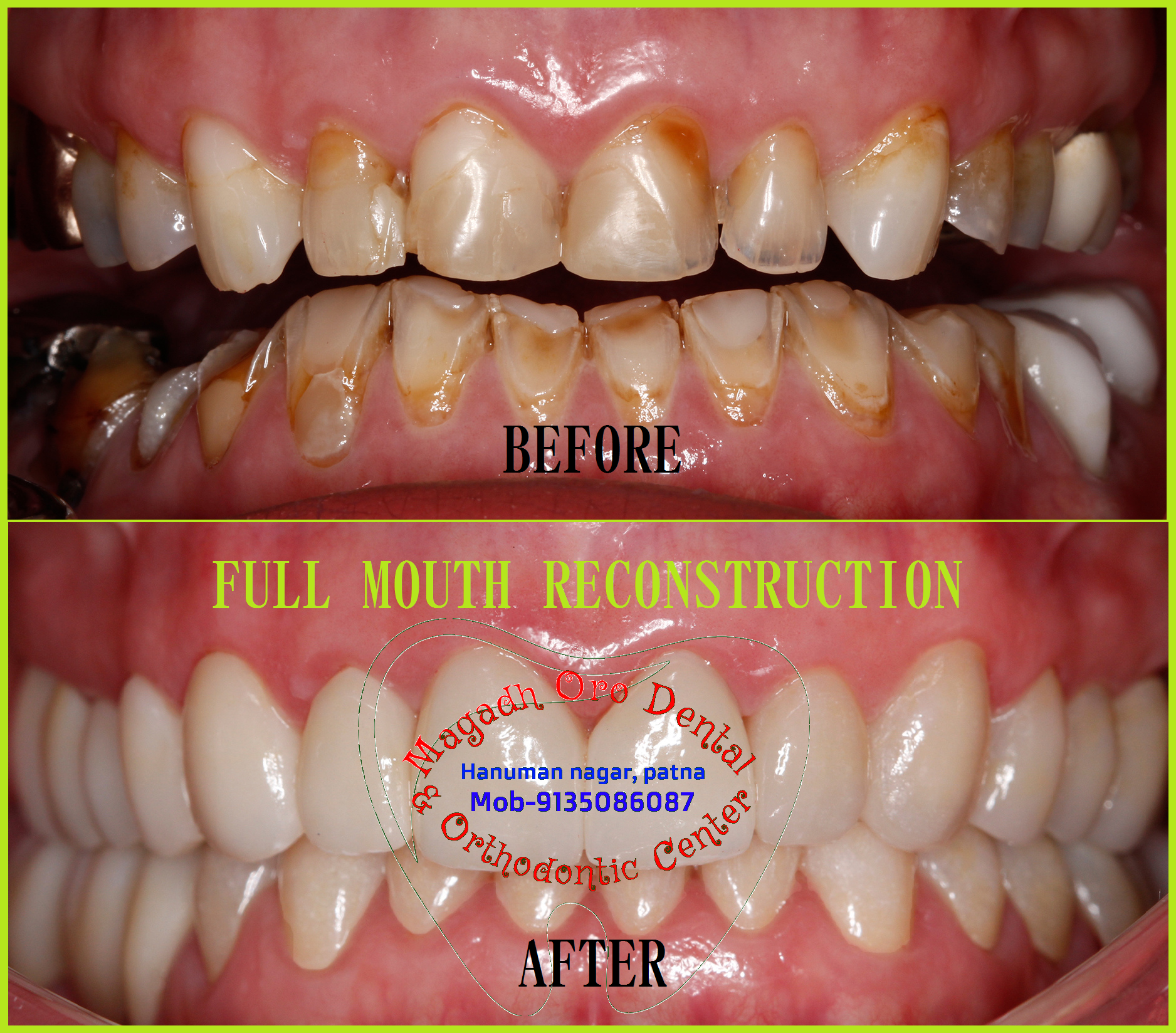 Magadh Oro Dental & Orthodontic Center Image 3