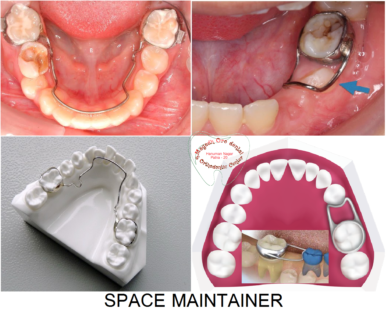 Magadh Oro Dental & Orthodontic Center Image 5