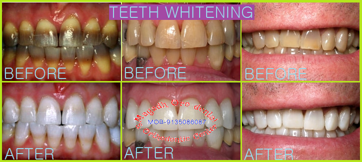 Magadh Oro Dental & Orthodontic Center Image 7