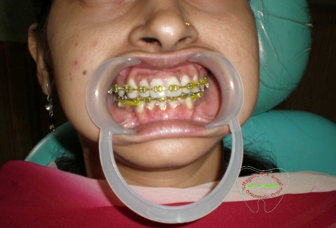 Magadh Oro Dental & Orthodontic Clinic Image 4