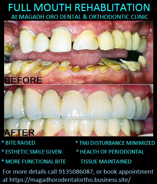 Magadh Oro Dental & Orthodontic Clinic Image 7