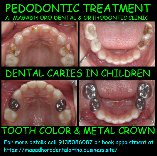 Magadh Oro Dental & Orthodontic Clinic Image 11