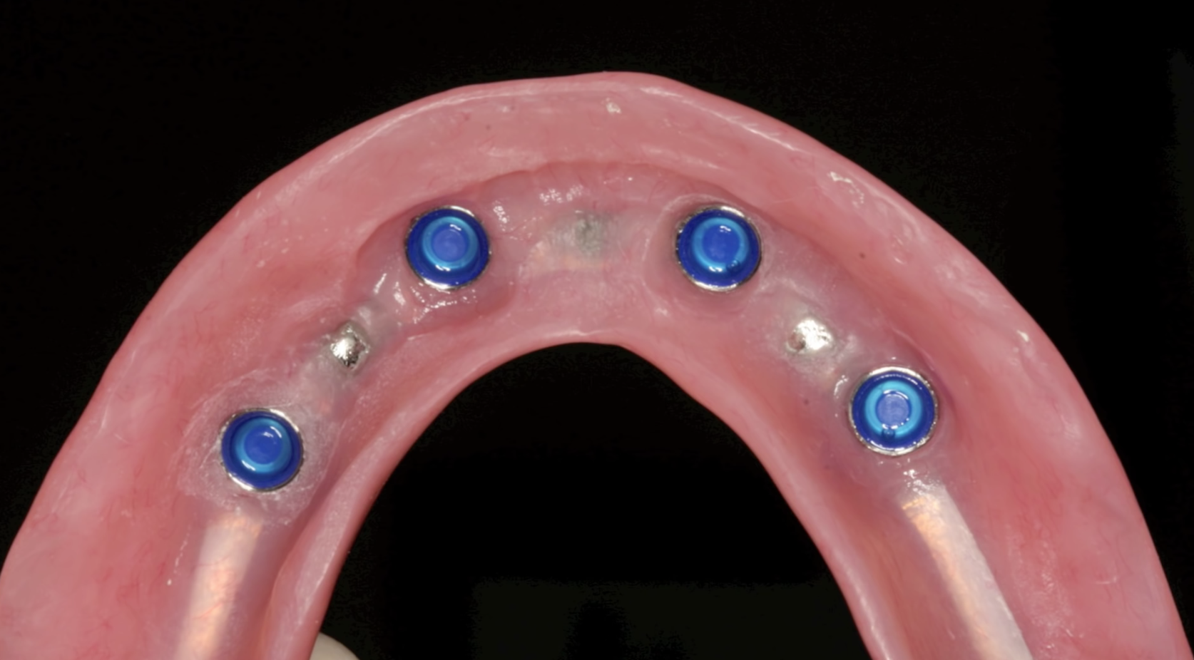Dr Sankpals Dental centre Image 11