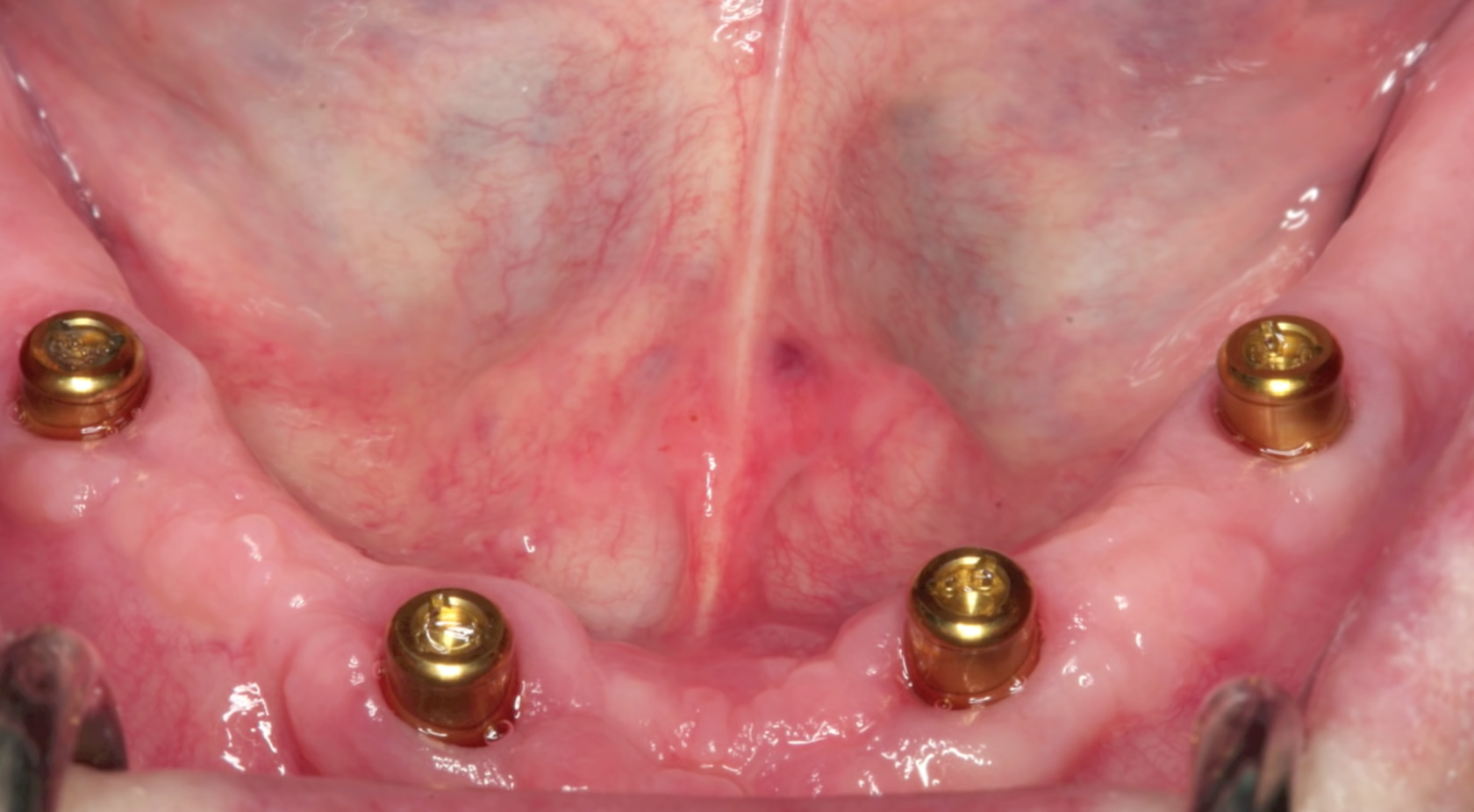Dr Sankpals Dental centre Image 10