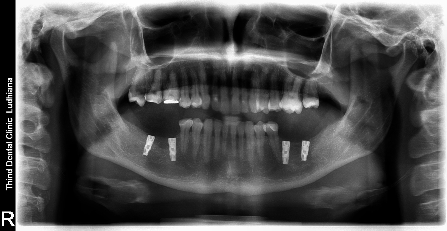thind dental clinic Image 5
