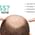 Spandan Plastic Surgery& Hair Transplant Center Image 3